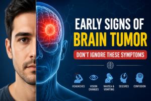 Early Signs of Brain Tumor You Should Never Ignore